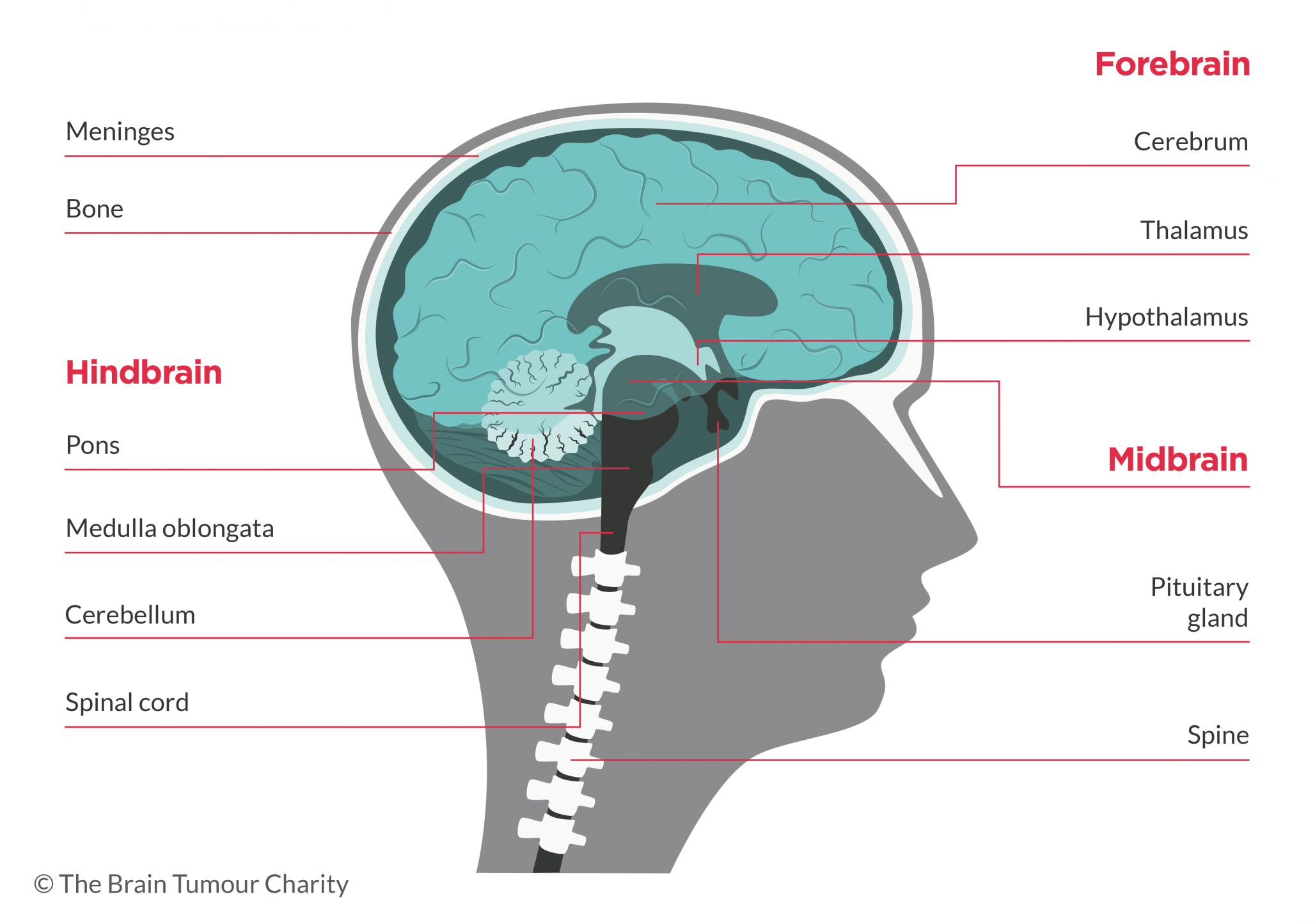 cross section vector image of the brain showing the area where a pineoblastoma could develop