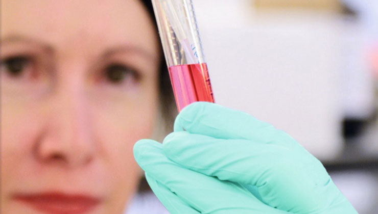 A woman in a lab coat holding a tube of blood, showcasing the impact of our funded research on life quality and survival rates.