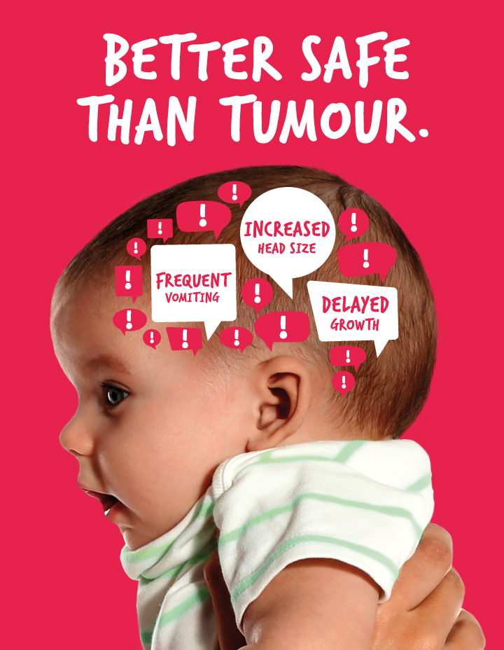 Check the signs and symptoms of a brain tumour