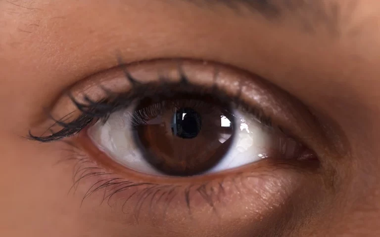 close-up of woman's eye experiencing vision problems 