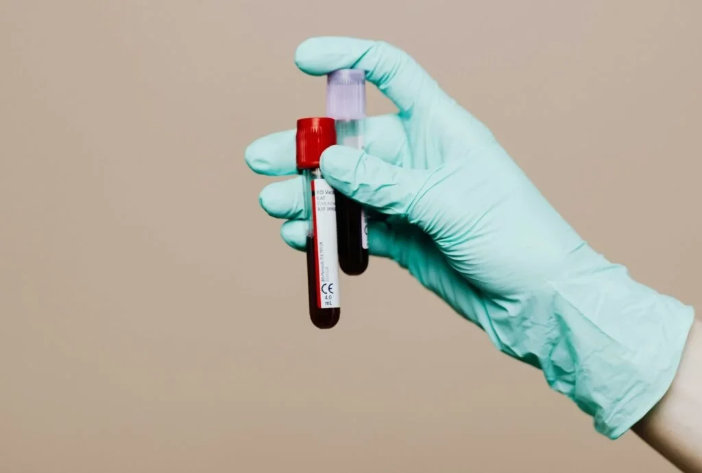 Are liquid biopsies a simpler way to detect brain tumours?