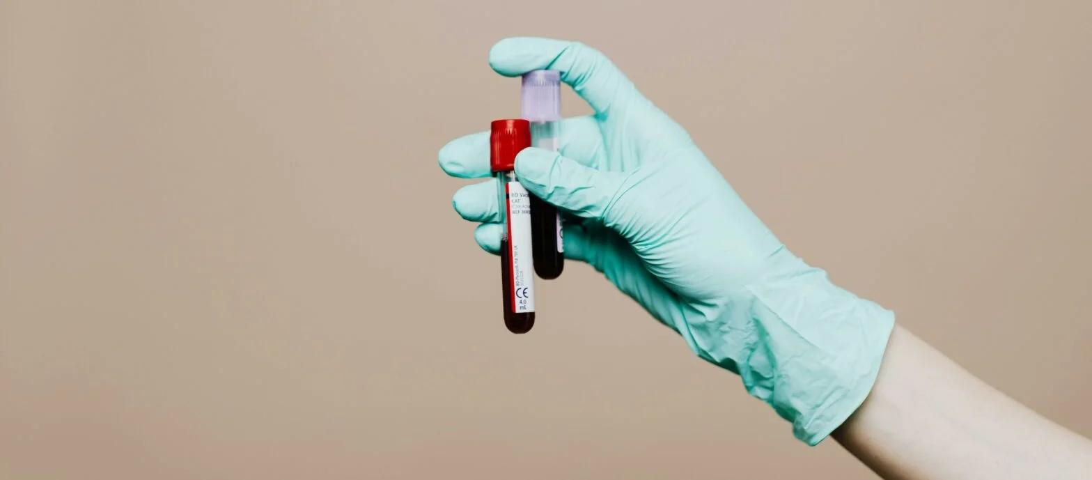Hand in surgical glove holding a blood sample for liquid biopsies