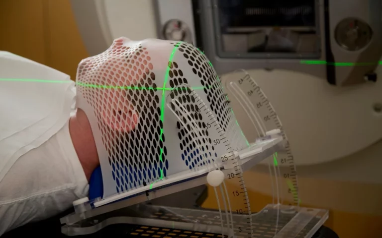 A person receiving stereotactic radiotherapy