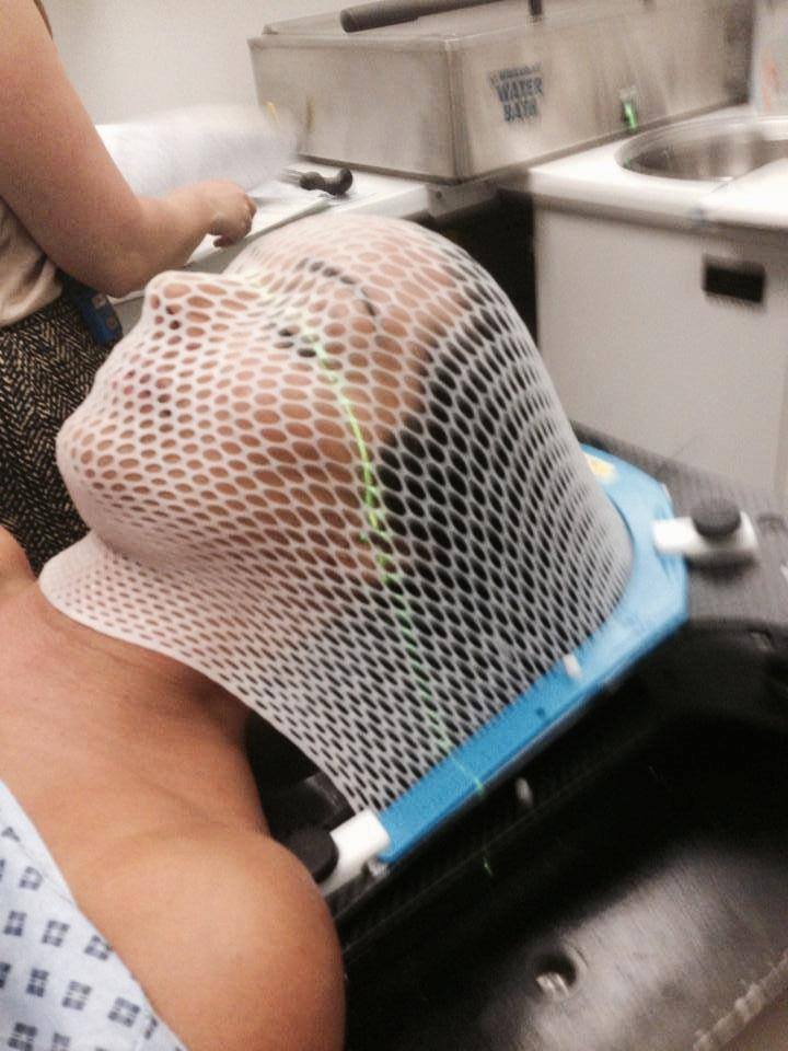 Lisa Connell lying on her back with a radiotherapy mask over her face