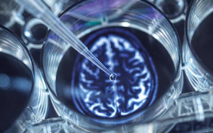 A dropper hovering over a Petri dish with a brain scan showing underneath the dish