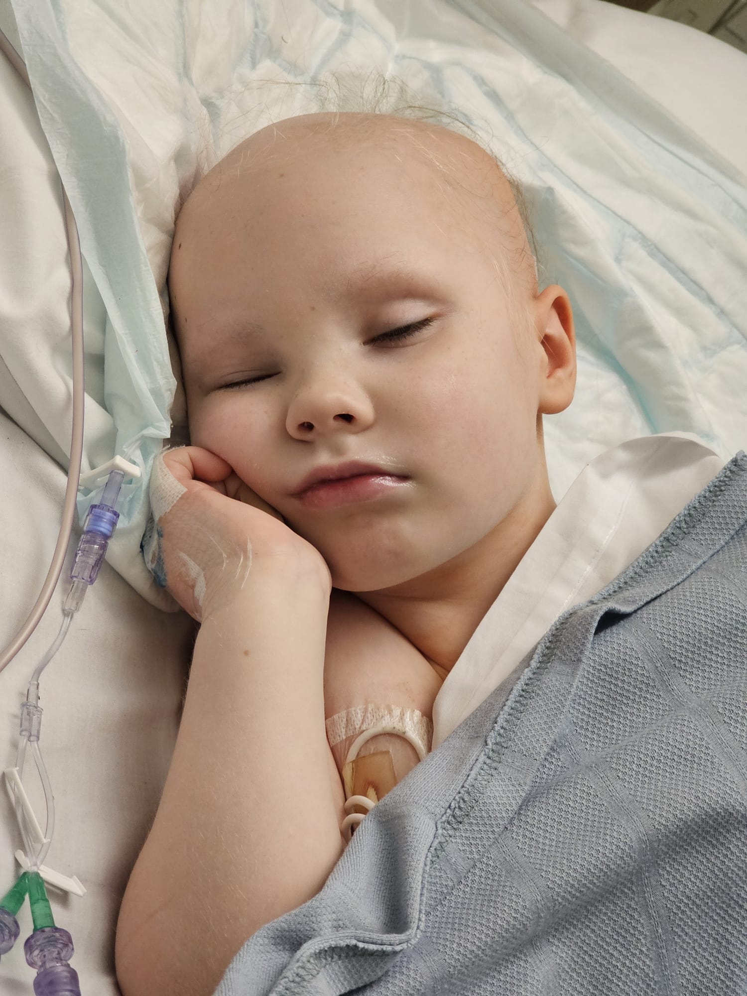A young child sleeping in hospital