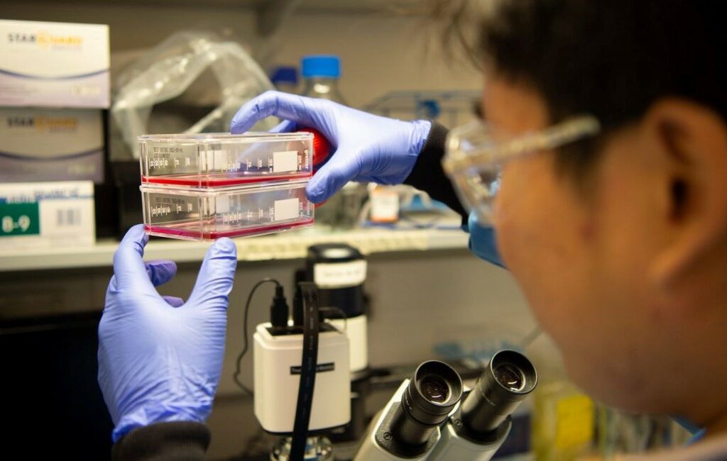 AI tool could help tailor treatment for most common adult brain tumour  